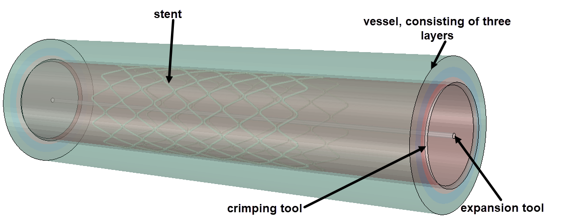 stent_model_setup